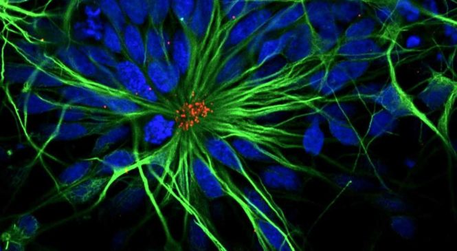 Ученые вернули молодость стволовым клеткам нервной ткани